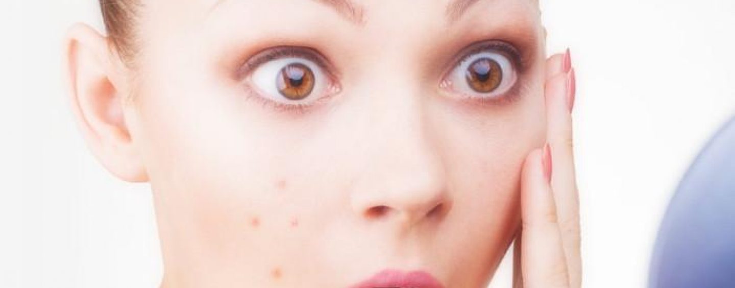 acne rea 2016