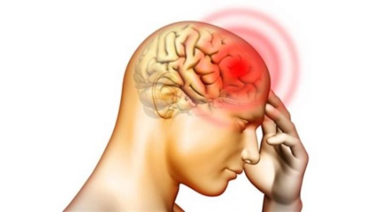 SPECIALE/ “Il MedicoInforma”, dott. Rosciano: “Cos’è e come si manifesta la meningite”