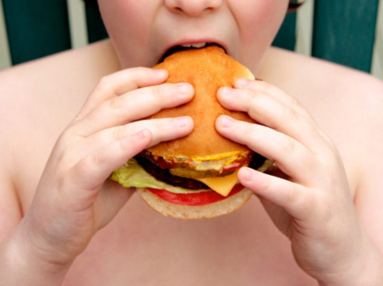 “Obesity Day”: giornata di prevenzione e informazione al Moscati