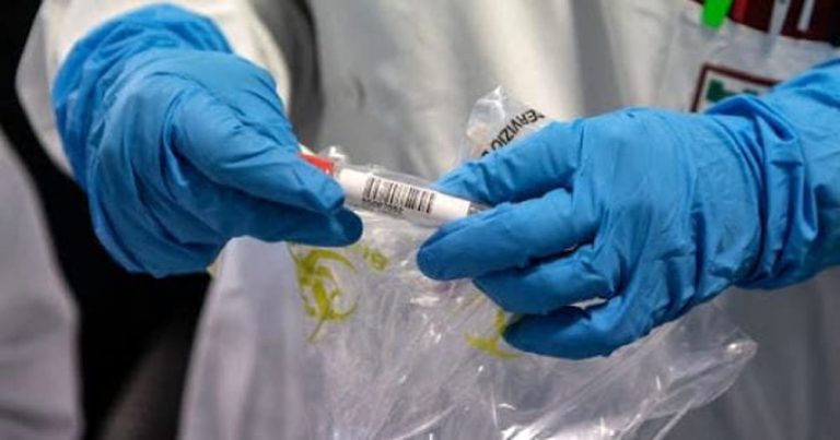 Covid-19, gli ultimi dati aggiornati per regione