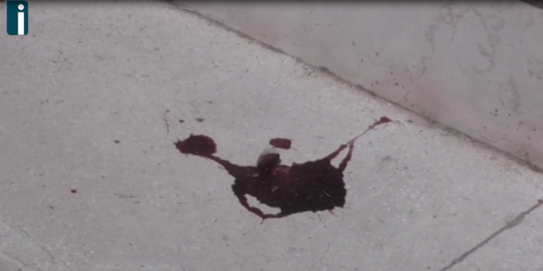 Video/Sparatoria a parco Palatucci. Chiazze di sangue nei pressi dell’abitazione della sorella, il 36enne non era in auto